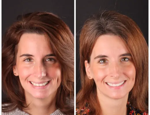 smile transformation austin artistic dental
