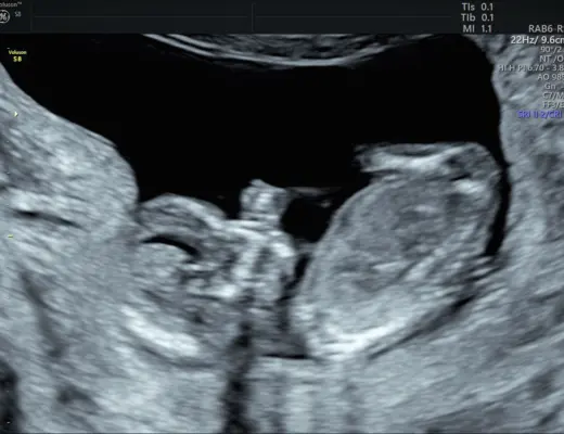 How to get a free baby box and samples in 2022 1 Image 7